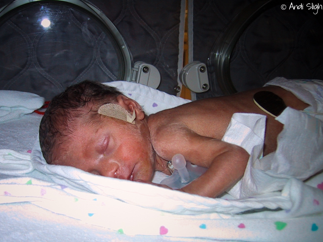preemie, premature birth, baby, NICU, cerebral palsy