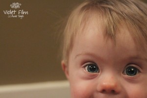 Down syndrome, almond shaped eyes, baby