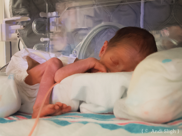 premature-baby-in-incubator